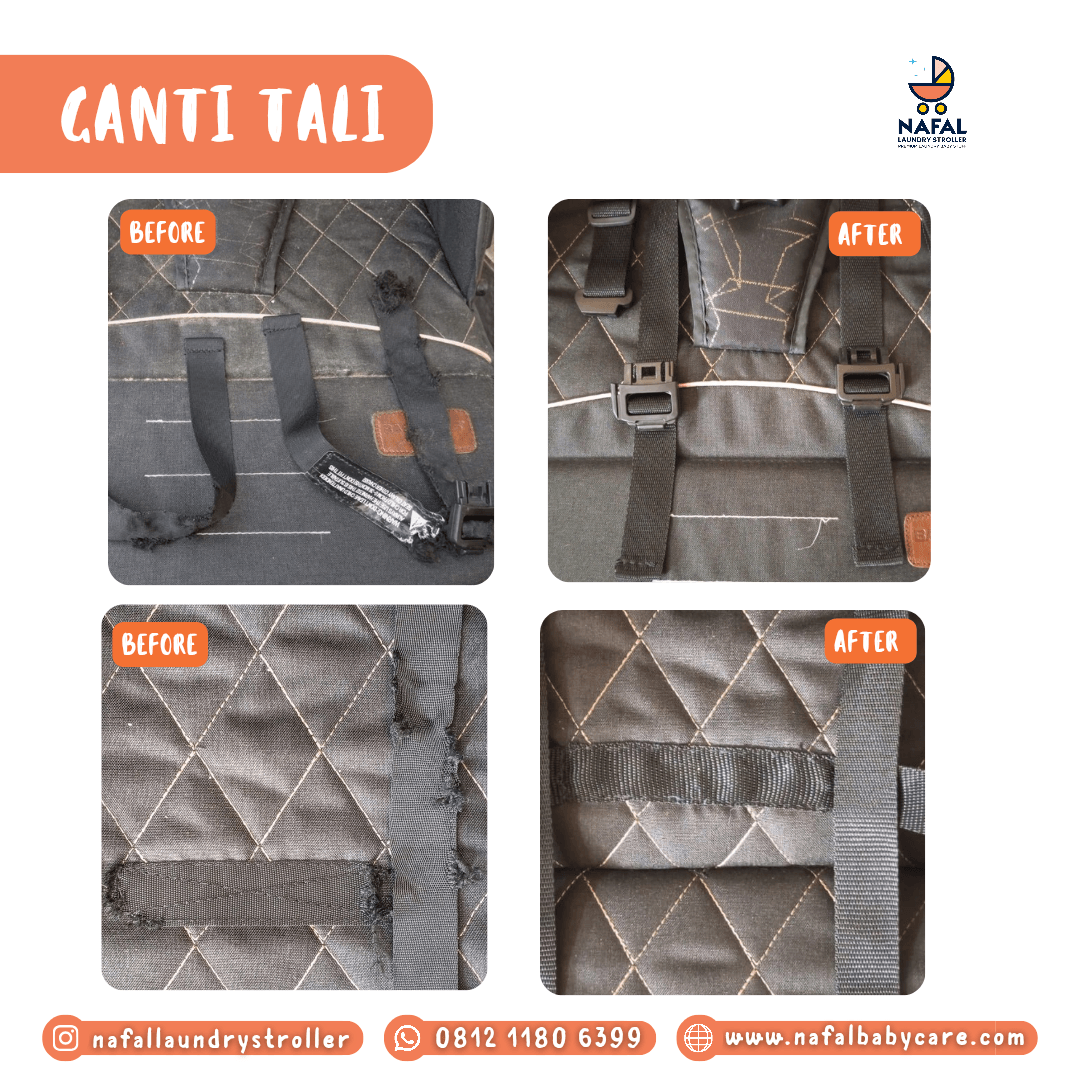 Foto pengerjaan Ganti Tali - Nafal Baby Care